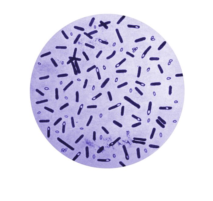 Figure 1: Microscopic view of gentian violet-stained Clostridium botulinum and their spores. Source: Public Health Image Library, Center for Disease Control (1979).